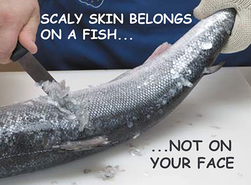 Only Fish Need Scales, Scaly Skin
